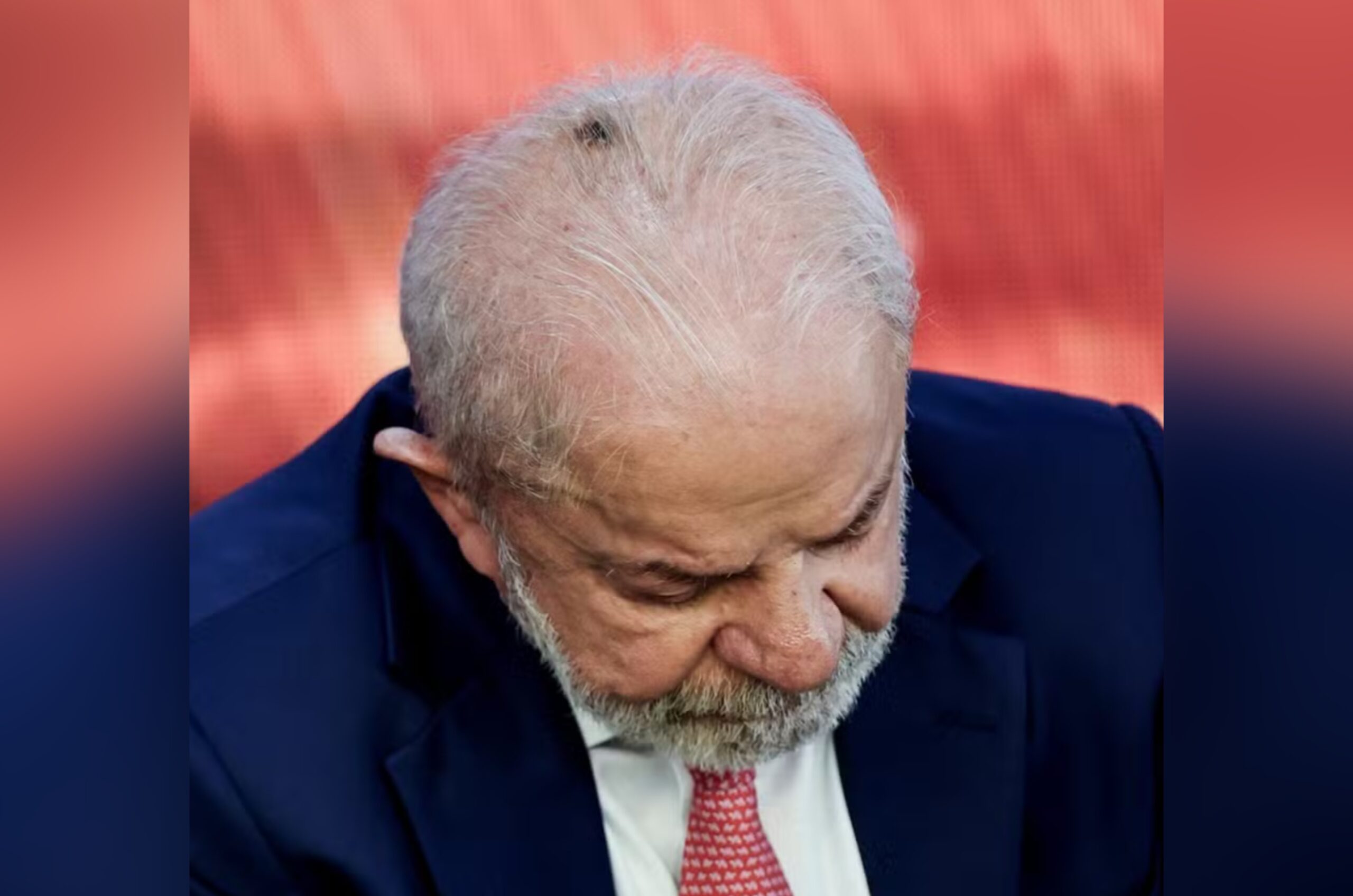 Lula fará retirada de acúmulo de pele e infiltração no punho para tratar tendinite, diz Planalto