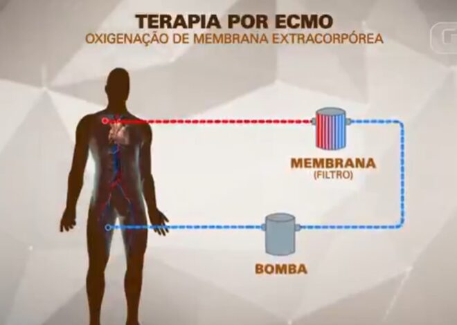 MC Marcinho usa terapia conhecida como ECMO, espécie de pulmão artificial; entenda como funciona